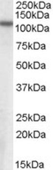 CADM4 Antibody
