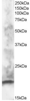 CABP1 Antibody