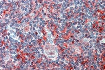 BRUNOL5 Antibody