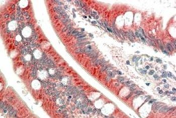 BNIP1 Antibody