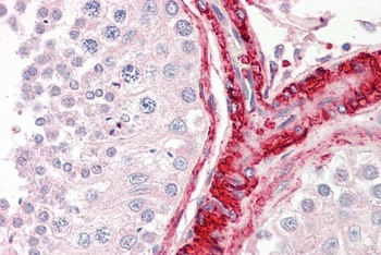 BAG5 Antibody