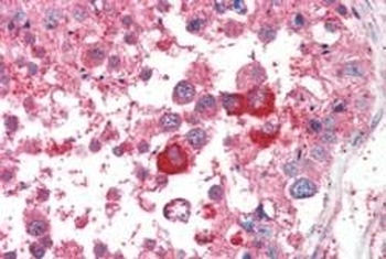 EIF3M Antibody