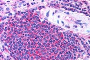 ATGL Antibody
