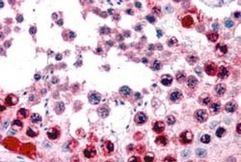ATF7 Antibody