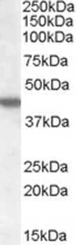 ASF1A Antibody
