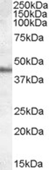 TBC1D4 Antibody