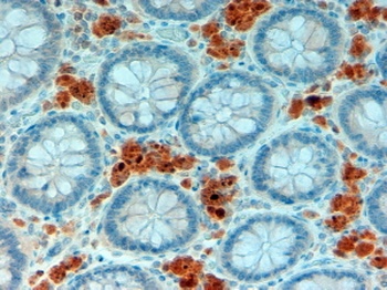 TBC1D4 Antibody