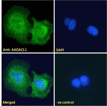 CYP19A1 Antibody