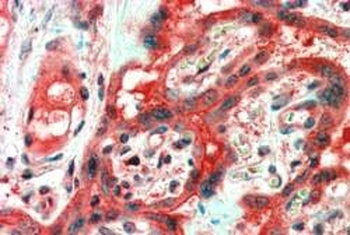 ARMET Antibody