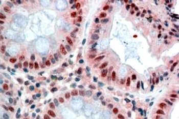 ARF1 Antibody