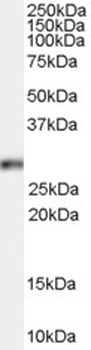 ALOX5 Antibody