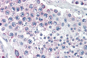 AOC3 Antibody