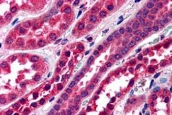 STXBP6 Antibody