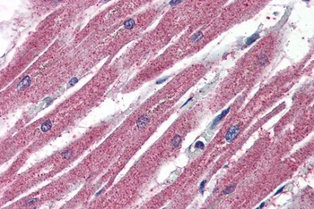 AMID Antibody