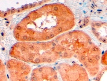 AMID Antibody