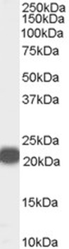 SIRT1 Antibody
