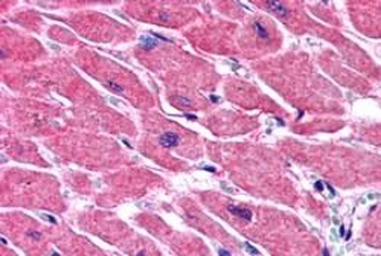 ALS2CR2 Antibody