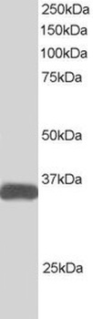 STRADB Antibody