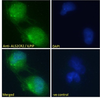 ALS2CR2 Antibody