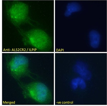 STRADB Antibody