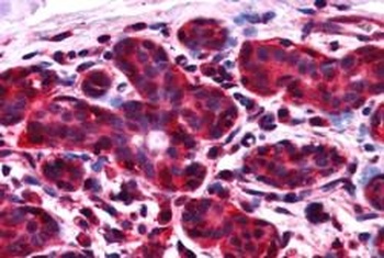 ALS2CR1 Antibody