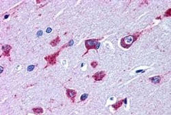 ALS2 Antibody