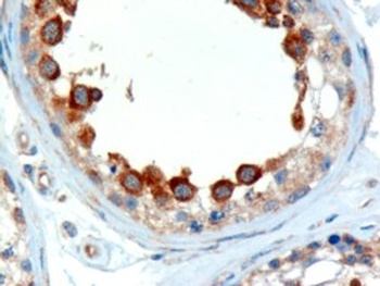 ALMS1 Antibody