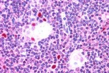AIRE Antibody