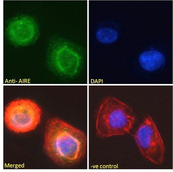 AIRE Antibody