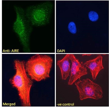 AIRE Antibody