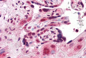 AIP Antibody