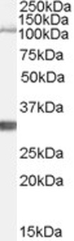 AIP Antibody