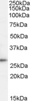 ITCH Antibody