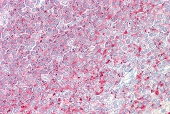 AIF4 Antibody