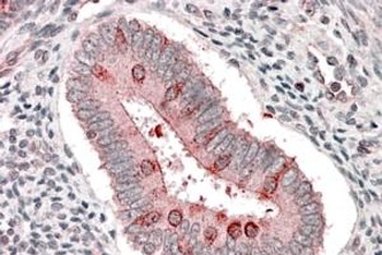 TSC1 Antibody