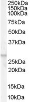 AGRP Antibody