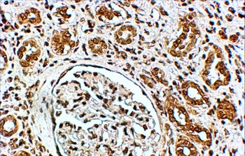 ADRB2 Antibody
