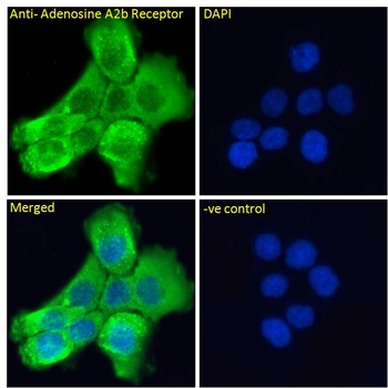 Adenosine A2 beta Receptor Antibody