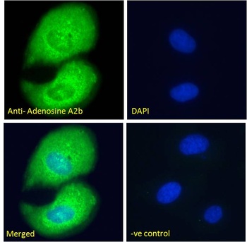 Adenosine A2 beta Receptor Antibody