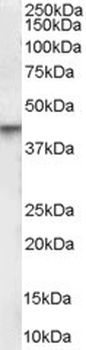 Adenosine A2 beta Receptor Antibody