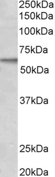 ACVRL1 Antibody