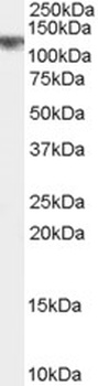 ACOX2 Antibody