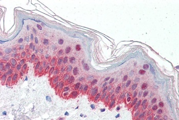 ACOX2 Antibody