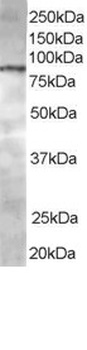 ACAP1 Antibody