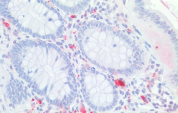 CDX2 Antibody