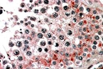 ABCB9 Antibody