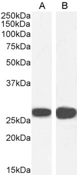 14-3-3 sigma Antibody