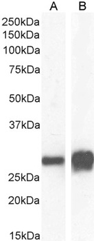 14-3-3 sigma Antibody