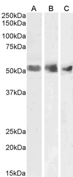VHL Antibody