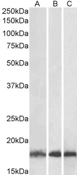 UBE2L3 Antibody